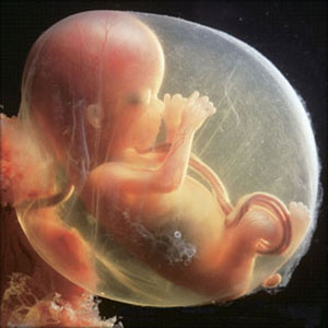 胎儿横位脐带缠绕怎么办